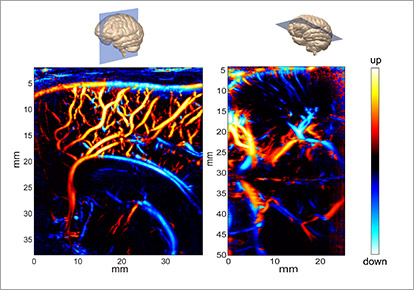 neurosciences