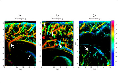 neurosciences